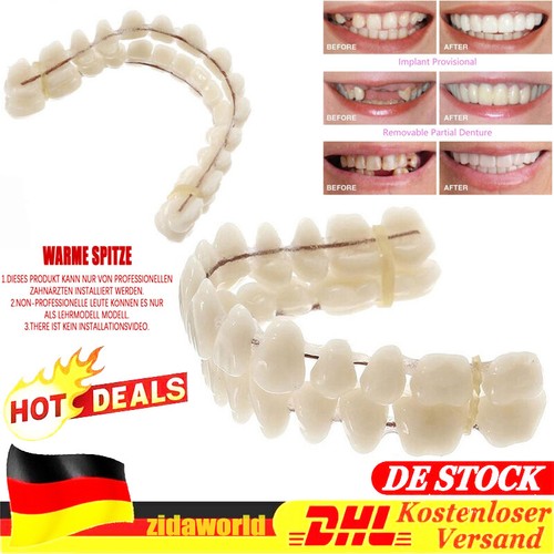 Snap veneers kosmetische - snap,