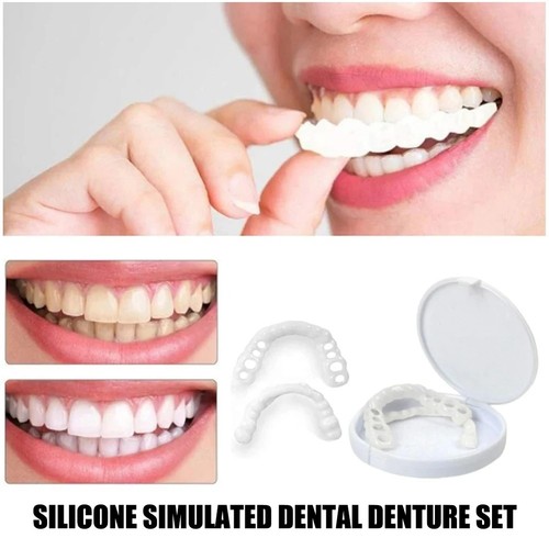 Snap veneers kosmetische - veneers,