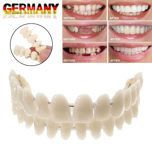 Snap veneers kosmetische - snap, on